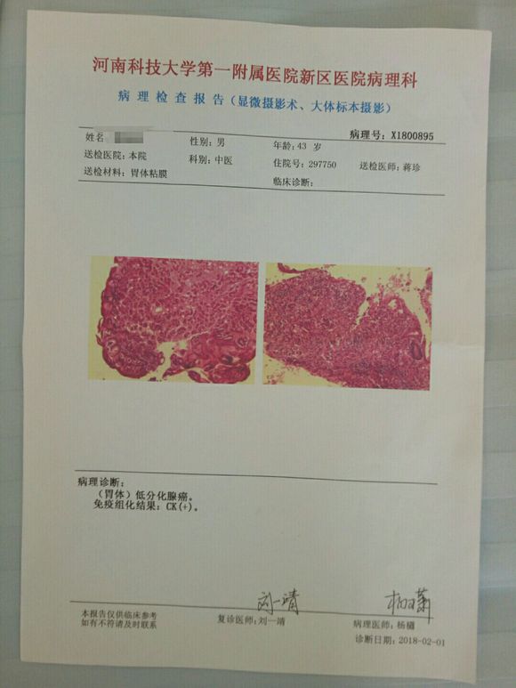 胃部低分化腺癌！好迷茫！看到爸爸好心酸！