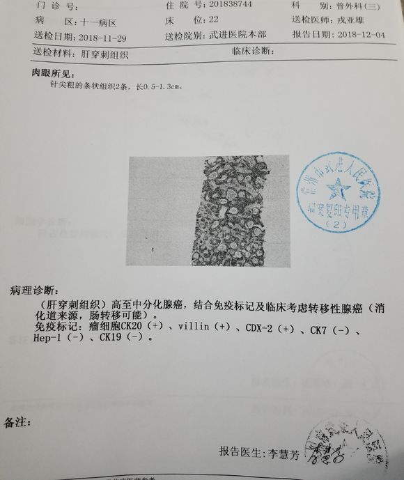 父亲结肠恶性肿瘤晚期记录治疗点滴