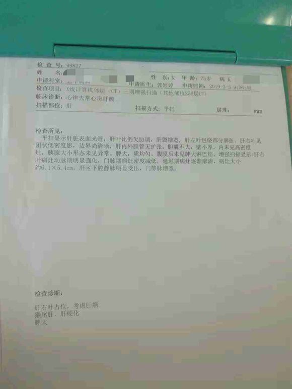 我妈患肝癌，医生说75岁了，建议介入治疗