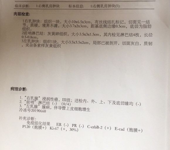 这种三阴乳腺癌属于几期