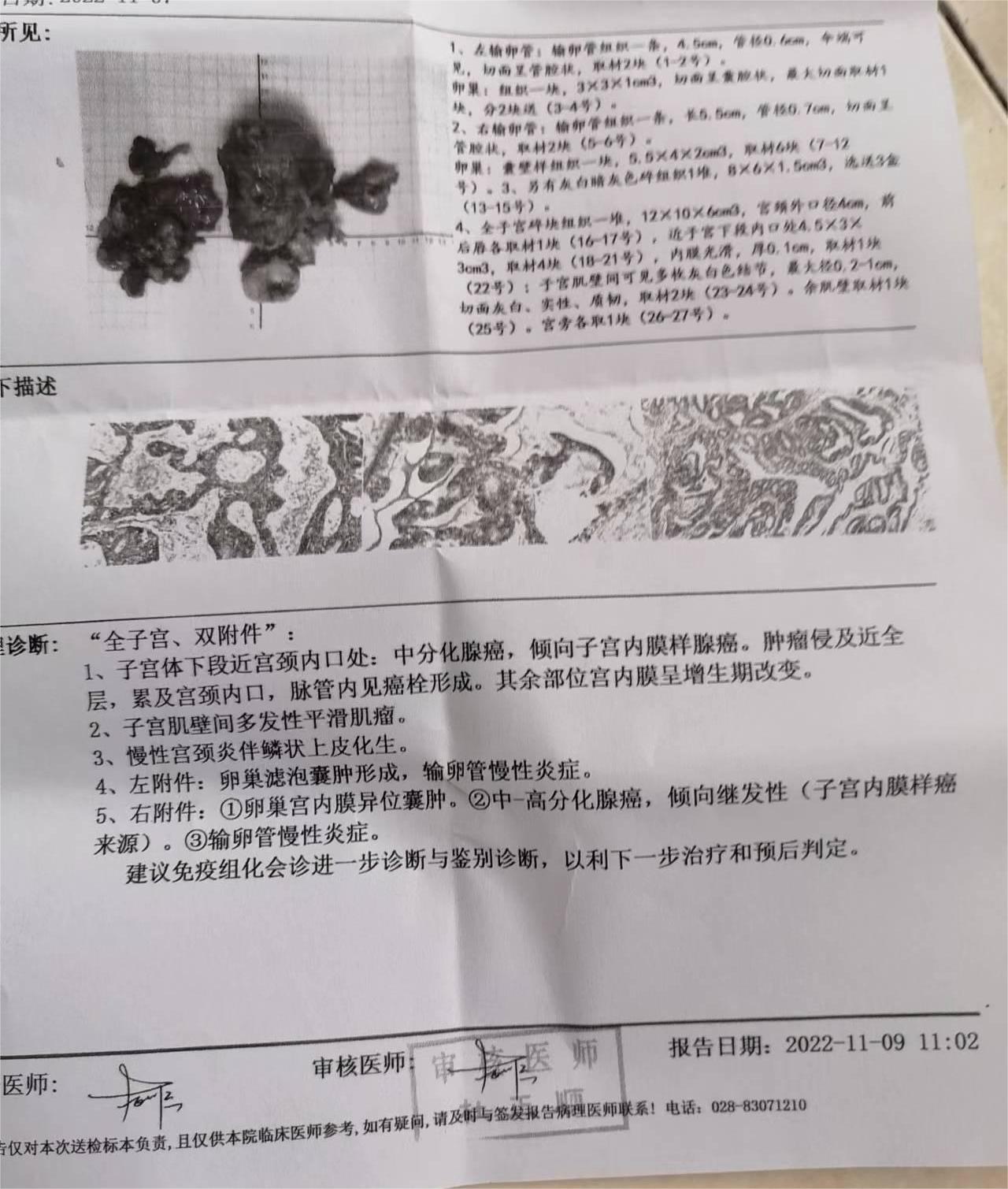 有人能说说这是确定癌症了吗，建议免疫组化检查