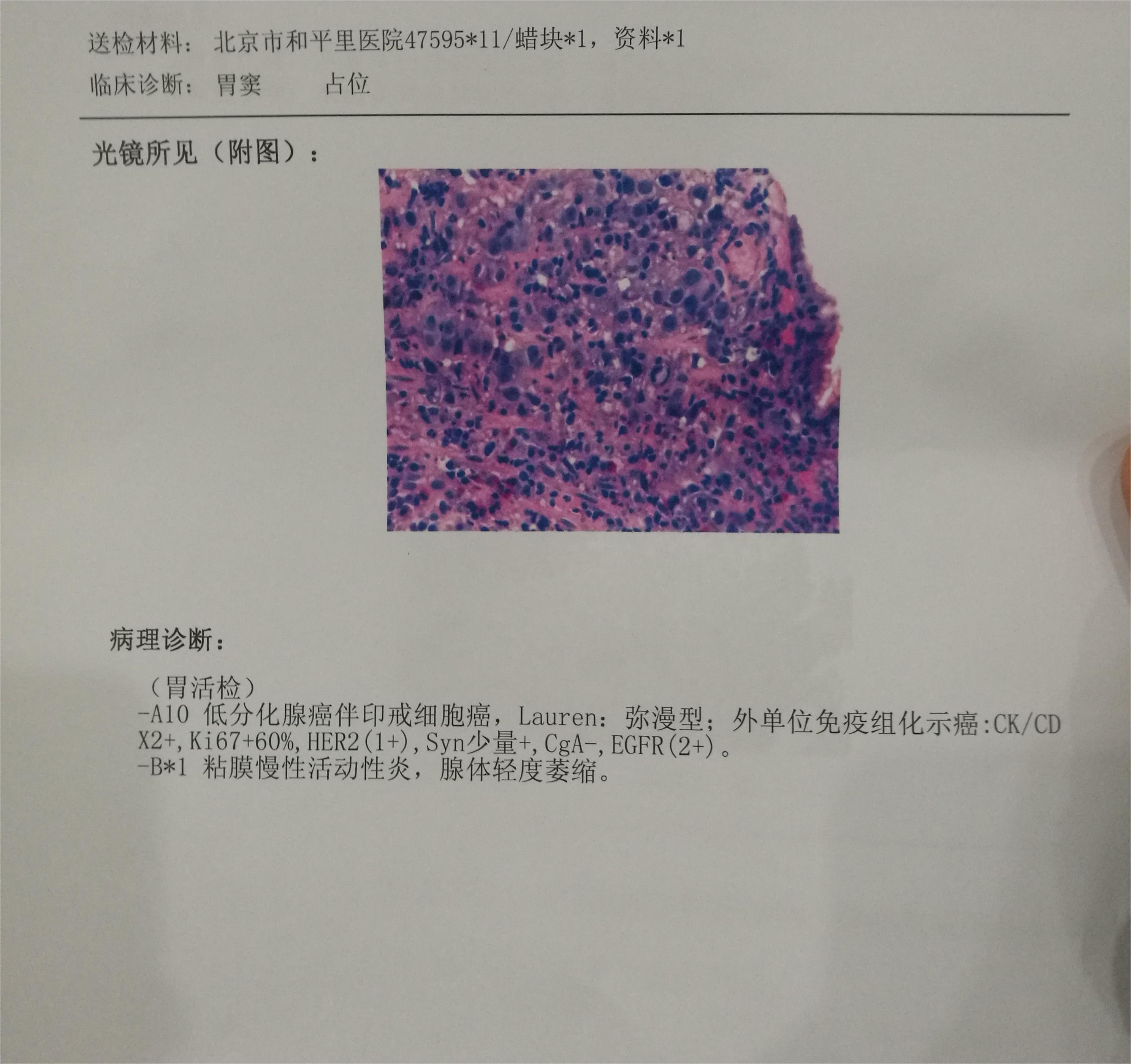 请大家帮我看看，这算什么程度了，我医生和家人都不给我解释