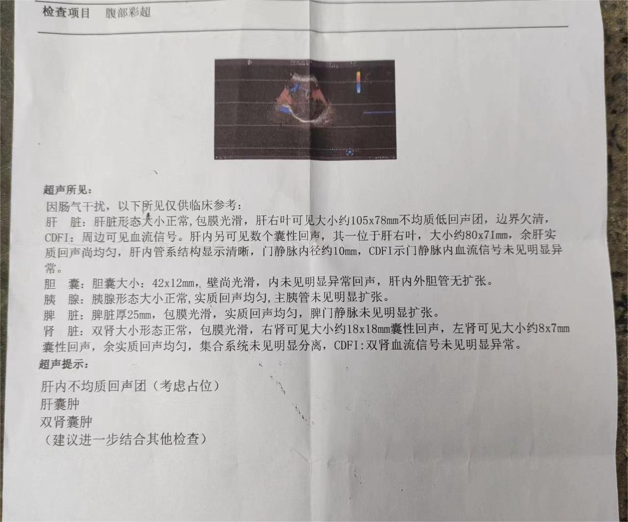 看一下，家里老人的