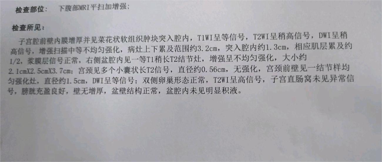 妈妈子宫癌三期